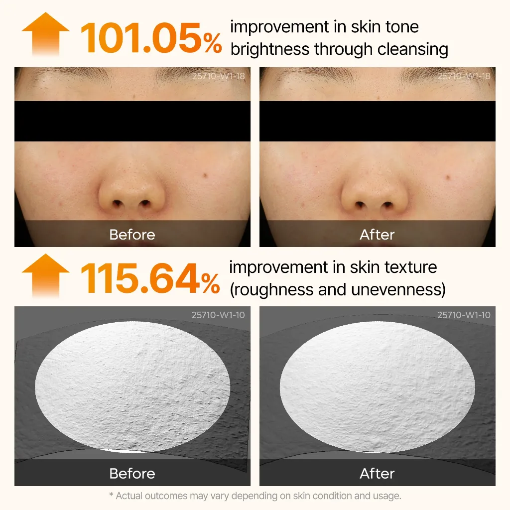 06_Peel_Shot_Kojik_Acid_Turmeric_Serum.webp